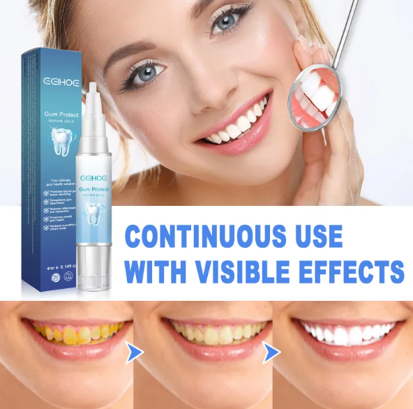 Teeth Repair Gel - Image26755087106142