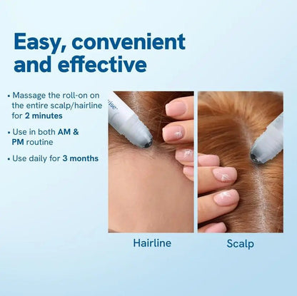 Hair Ball Essence Rosemary Growth Oil - Image26755162013790