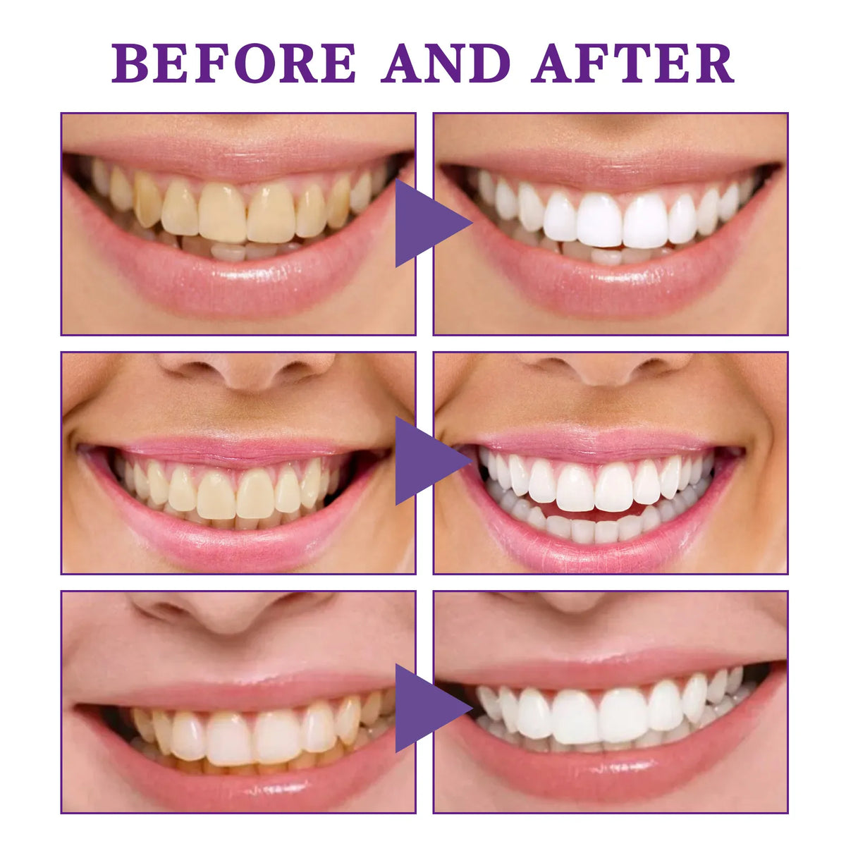 V34 Tooth Cleaning Mousse - 