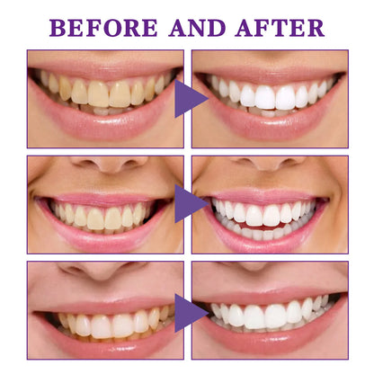 V34 Tooth Cleaning Mousse - Image26755086614622