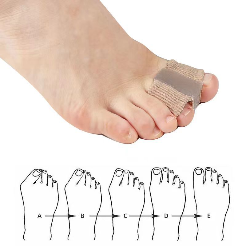 Fiber Toe Separator - 