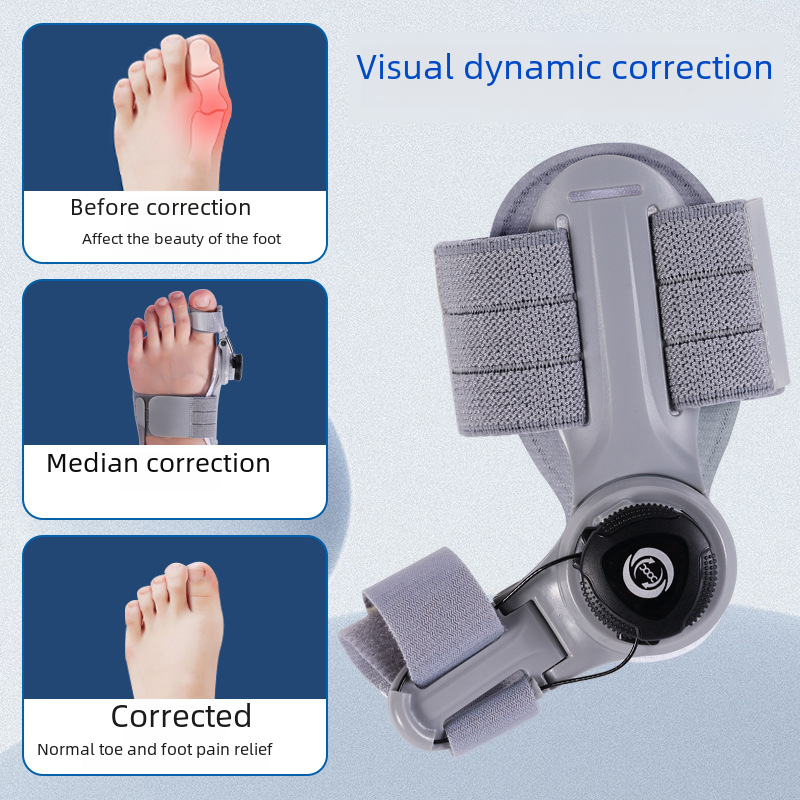 Upgraded Adjustable Bunion Corrector - 
