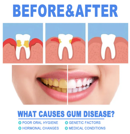 Teeth Repair Gel - Image26755087073374