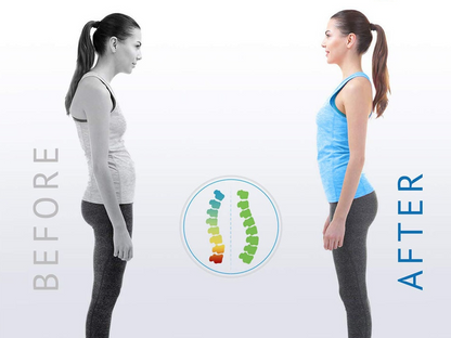 Posture Corrector - Image26755317301342