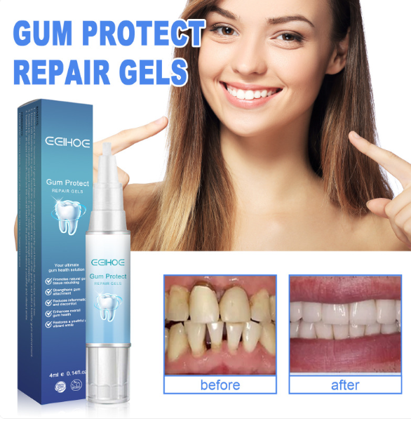 Teeth Repair Gel - Image26755087138910